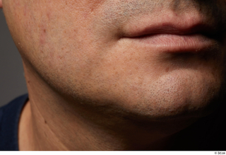 HD Face Skin Harrison Hill chin face skin pores skin…